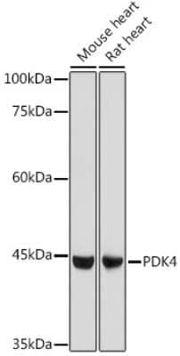 Western Blot: PDK4 Antibody [NBP2-95194] - Western blot analysis of extracts of various cell lines, using PDK4 antibody (NBP2-95194) at 1:1000 dilution. Secondary antibody: HRP Goat Anti-Rabbit IgG (H+L) at 1:10000 dilution. Lysates/proteins: 25ug per lane. Blocking buffer: 3% nonfat dry milk in TBST. Detection: ECL Basic Kit. Exposure time: 1s.